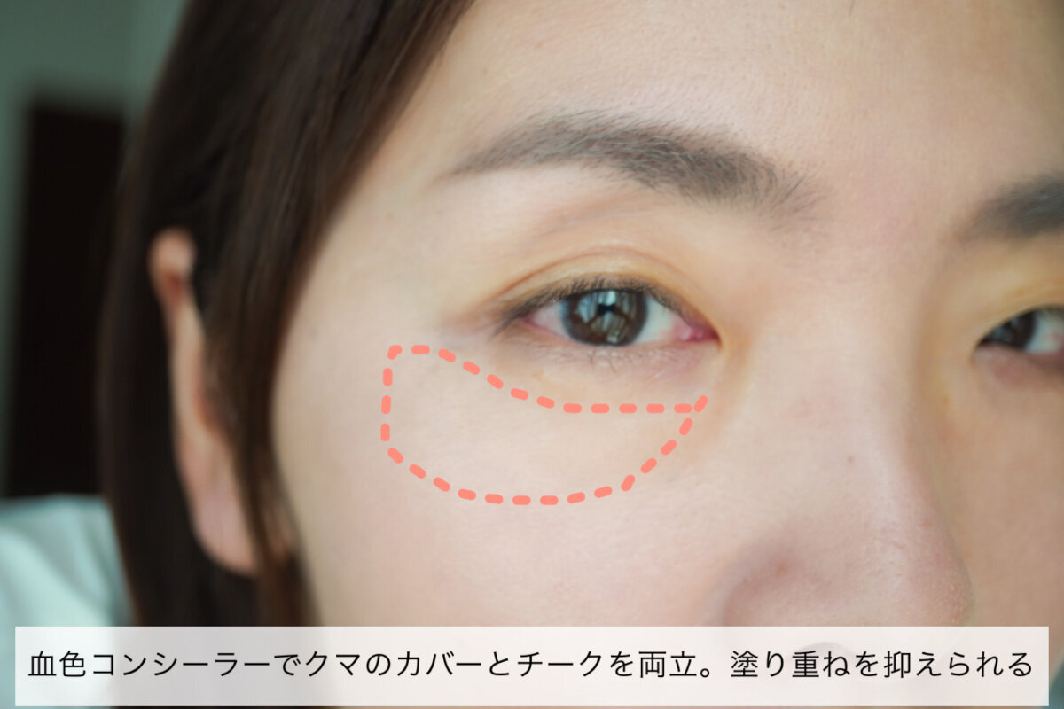 女性の目元アップ。目の下のクマの範囲が点線で示されている。