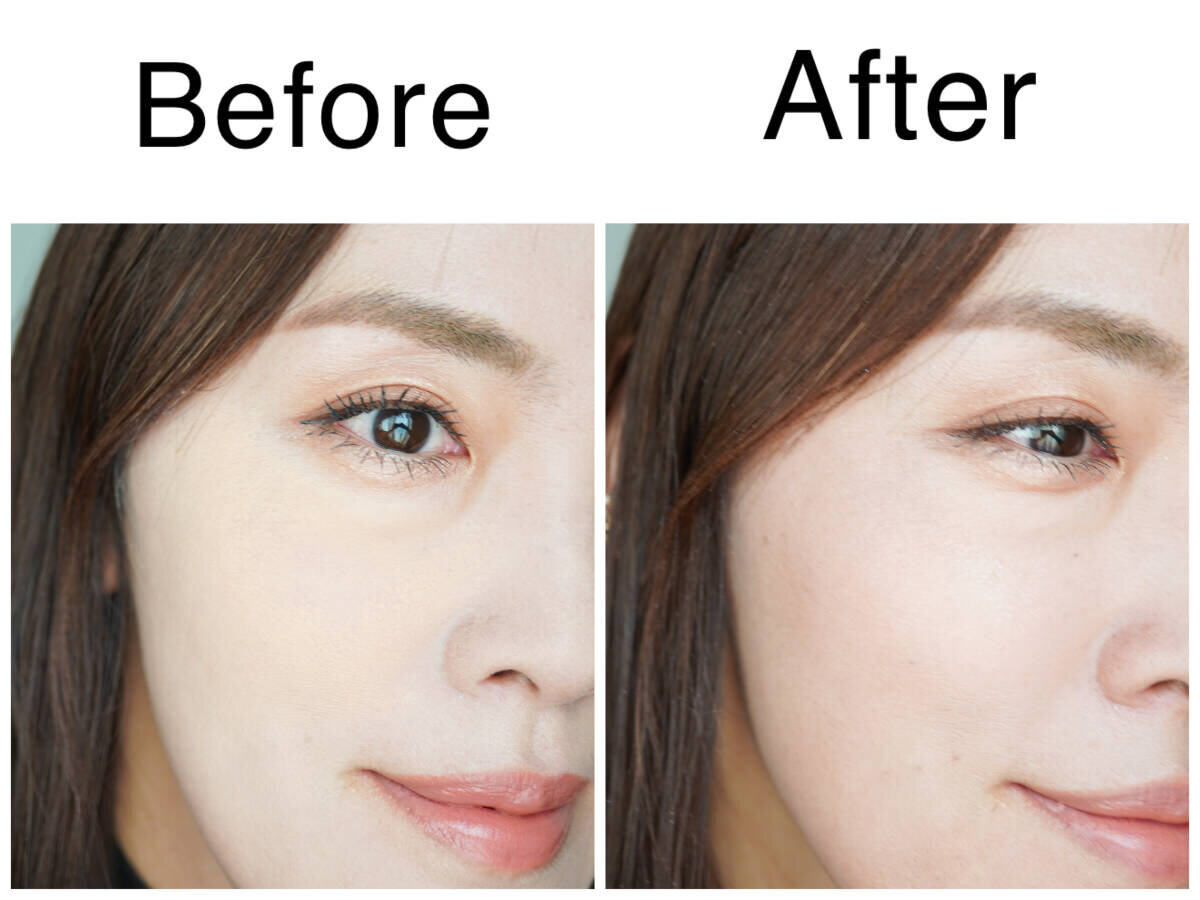40代女性の顔のBefore（左）とAfter（右）の比較。Afterの方が若々しい印象。