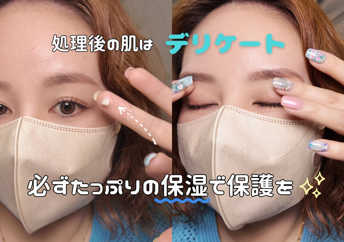 処理後のデリケートな肌に指でクリームを塗り優しく保湿している様子 処理後のデリケートな肌に指でクリームを塗り優しく保湿している様子